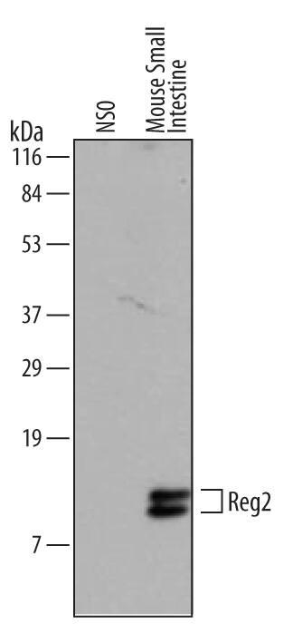 Western blot shows lysates of NS0 mouse myeloma cell line, mouse small intestine and pancreas tissue. PVDF membrane was probed with 2 µg/mL of Mouse Reg2 Monoclonal Antibody (Catalog # MAB2098) followed by HRP-conjugated Anti-Rat IgG Secondary Antibody (Catalog # HAF005). This experiment was conducted under reducing conditions and using Immunoblot Buffer Group 1.