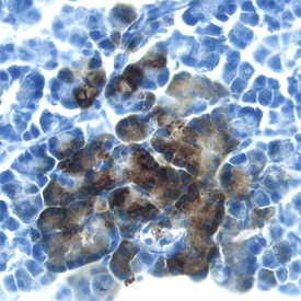 Reg3B was detected in perfusion fixed frozen sections of rat pancreas using Mouse Anti-Rat Reg3B Monoclonal Antibody (Catalog # MAB1996) at 25 µg/mL overnight at 4 °C. Tissue was stained using the Anti-Mouse HRP-DAB Cell & Tissue Staining Kit (brown; Catalog # CTS002) and counterstained with hematoxylin (blue). Specific labeling was localized to the cytoplasm of exocrine cells. View our protocol for Chromogenic IHC Staining of Frozen Tissue Sections.