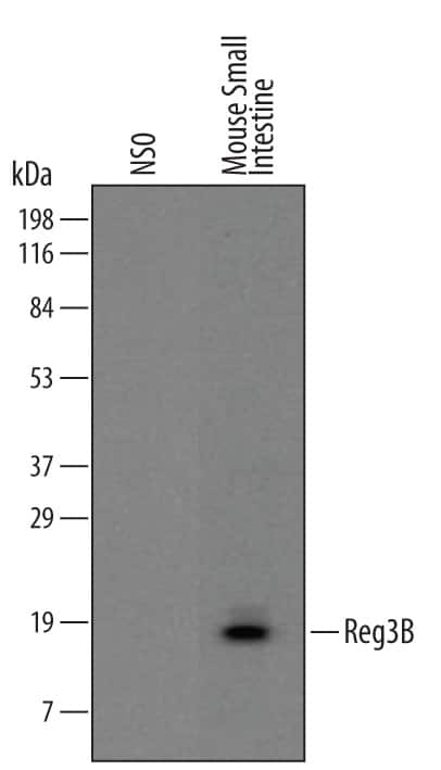 Western Blot Reg3B Antibody (518630)