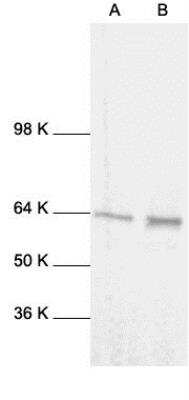 Western blots show p65 antibodies that passed the test of specificity