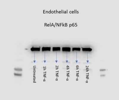 RelA/NFkB p65 Antibodies: Novus Biologicals