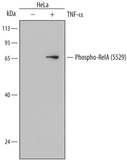 Western blot shows lysates of HeLa human cervical epithelial carcinoma cell line untreated (-) or treated (+) with 20 ng/mL Recombinant Human TNF-a (Catalog # 210-TA) for 10 minutes. PVDF membrane was probed with 1 µg/mL of Mouse Anti-Human Phospho-RelA/NF kappa B p65 (S529) Monoclonal Antibody (Catalog # MAB7624) followed by HRP-conjugated Anti-Mouse IgG Secondary Antibody (Catalog # HAF018). A specific band was detected for Phospho-RelA/NF kappa B p65 (S529) at approximately 65 kDa (as indicated). This experiment was conducted under reducing conditions and using Immunoblot Buffer Group 1.