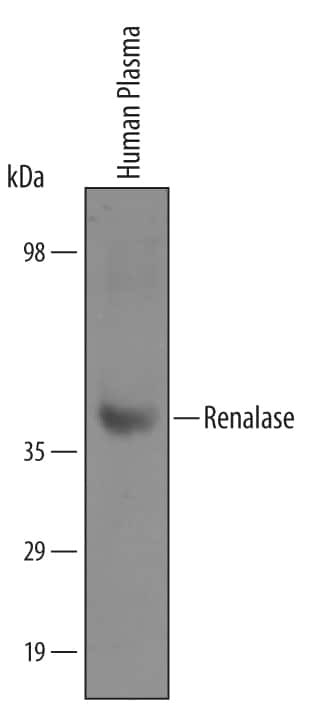 Western blot shows lysates of human plasma. PVDF membrane was probed with 1 µg/mL of Goat Anti-Human Renalase Antigen Affinity-purified Polyclonal Antibody (Catalog # AF5350) followed by HRP-conjugated Anti-Goat IgG Secondary Antibody (Catalog # HAF019). A specific band was detected for Renalase at approximately 37 kDa (as indicated). This experiment was conducted under reducing conditions and using Immunoblot Buffer Group 8.