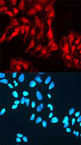 Rex-1/ZFP42 was detected in immersion fixed NTera-2 human testicular embryonic carcinoma cell line using Sheep Anti-Human Rex-1/ZFP42 Antigen Affinity-purified Polyclonal Antibody (Catalog # AF3598) at 10 µg/mL for 3 hours at room temperature. Cells were stained using the NorthernLights™ 557-conjugated Anti-Sheep IgG Secondary Antibody (red, upper panel; Catalog # NL010) and counterstained with DAPI (blue, lower panel). Specific staining was localized to nuclei. View our protocol for Fluorescent ICC Staining of Cells on Coverslips.