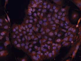 Rex‑1 was detected in immersion fixed BG01V human embryonic stem cells using 10 µg/mL Human Rex‑1 Biotinylated Antigen Affinity-purified Polyclonal Antibody (Catalog # BAF3598) for 3 hours at room temperature. Cells were stained with the NorthernLights™ 557-conjugated Streptavidin (red; Catalog # NL999) and counterstained with DAPI (blue). View our protocol for Fluorescent ICC Staining of Cells on Coverslips.