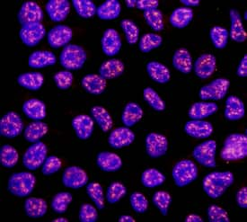 Rex‑1 was detected in immersion fixed NTera-2 human testicular embryonic carcinoma cell line using 10 µg/mL Human Rex‑1 Monoclonal Antibody (Catalog # MAB3598) for 3 hours at room temperature. Cells were stained with the NorthernLights™ 557-conjugated Anti-Rat IgG Secondary Antibody (red; Catalog # NL013) and counterstained with DAPI (blue). View our protocol for Fluorescent ICC Staining of Cells on Coverslips.