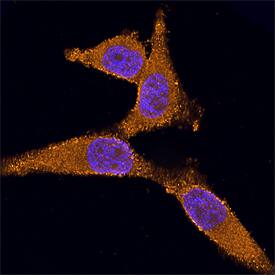 Ribosomal Protein S6/RPS6 was detected in formaldehyde fixed HeLa human cervical epithelial carcinoma cell line using Mouse Anti-Human Ribosomal Protein S6/RPS6 Biotinylated Monoclonal Antibody (Catalog # BAM5436) at 25 µg/mL for 3 hours at room temperature. Cells were stained using the NorthernLights™ 557-conjugated Streptavidin (orange; Catalog # NL999) and counterstained with DAPI (blue). Specific staining was localized to ribosomes. View our protocol for Fluorescent ICC Staining of Cells on Coverslips.