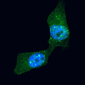 Ribosomal Protein S6/RPS6 was detected in formaldehyde fixed HeLa human cervical epithelial carcinoma cell line using Mouse Anti-Human/Mouse/Rat Ribosomal Protein S6/RPS6 Alexa Fluor® 488‑conjugated Monoclonal Antibody (Catalog # IC5436G) at 1:10 dilution for 3 hours at room temperature and counterstained with DAPI (blue). Specific staining was localized to ribosomes. View our protocol for Fluorescent ICC Staining of Cells on Coverslips.