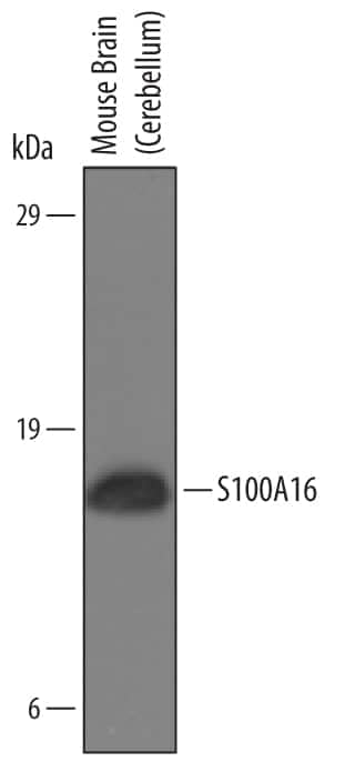 Western Blot S100A16 Antibody