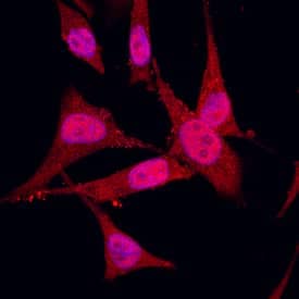 S100A2 was detected in immersion fixed MDA-MB-231 human breast cancer cell line using Goat Anti-Human S100A2 Antigen Affinity-purified Polyclonal Antibody (Catalog # AF4870) at 10 µg/mL for 3 hours at room temperature. Cells were stained using the NorthernLights™ 557-conjugated Anti-Goat IgG Secondary Antibody (red; Catalog # NL001) and counterstained with DAPI(blue). Specific staining was localized to nucleus and cytoplasm. View our protocol for Fluorescent ICC Staining of Cells on Coverslips.