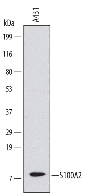 Western blot shows lysates of A431 human epithelial carcinoma cell line. PVDF Membrane was probed with 2 µg/mL of Human S100A2 Monoclonal Antibody (Catalog # MAB4870) followed by HRP-conjugated Anti-Mouse IgG Secondary Antibody (Catalog # HAF007). A specific band was detected for S100A2 at approximately 10 kDa (as indicated). This experiment was conducted under reducing conditions and using Immunoblot Buffer Group 1.