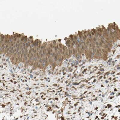 Immunohistochemistry-Paraffin S100A6 Antibody