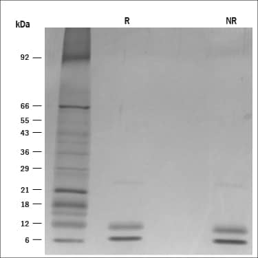 1 μg/lane of Recombinant Mouse S100A8/S100A9 was resolved withSDS-PAGE under reducing (R) andnon-reducing (NR) conditions and visualized by silver staining, showing R bands at6.3, 10.8 kDa and NR band at 6, 9.6 kDa.