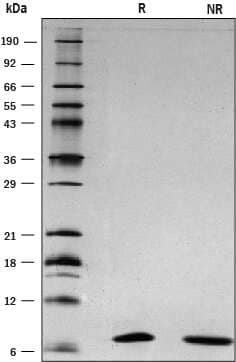 1 μg/lane of Recombinant Mouse S100A8 was resolved with SDS-PAGE under reducing (R) and non-reducing (NR) conditions and visualized by silver staining, showing bands at 7 kDa.