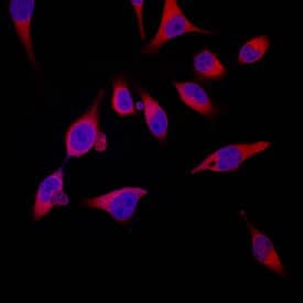 S100A8 was detected in immersion fixed HeLa human cervical epithelial carcinoma cell line using Sheep Anti-Human S100A8 Antigen Affinity-purified Polyclonal Antibody (Catalog # AF4570) at 10 µg/mL for 3 hours at room temperature. Cells were stained using the NorthernLights™ 557-conjugated Anti-Sheep IgG Secondary Antibody (red; Catalog # NL010) and counterstained with DAPI (blue). Specific staining was localized to cytoplasm. View our protocol for Fluorescent ICC Staining of Cells on Coverslips.