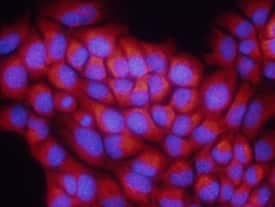 S100A8 was detected in immersion fixed NMuMG mouse mammary gland epithelial cell line using 10 µg/mL Goat Anti-Mouse S100A8 Biotinylated Antigen Affinity-purified Polyclonal Antibody (Catalog # BAF3059) for 3 hours at room temperature. Cells were stained with the NorthernLights™ 557-conjugated Streptavidin (red; Catalog # NL999) and counter-stained with DAPI (blue). View our protocol for Fluorescent ICC Staining of Cells on Coverslips.