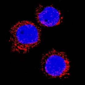 S100A8/S100A9 Heterodimer was detected in immersion fixed HL60 human promyelocytic leukemia cell line using Rabbit Anti-Human S100A8/S100A9 Heterodimer Monoclonal Antibody (Catalog # MAB45701) at 3 µg/mL for 3 hours at room temperature. Cells were stained using the NorthernLights™ 557-conjugated Anti-Rabbit IgG Secondary Antibody (red; Catalog # NL004) and counterstained with DAPI (blue). Specific staining was localized to cytoplasm (punctate). View our protocol for Fluorescent ICC Staining of Non-adherent Cells.