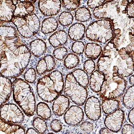     S100P  was detected in immersion fixed paraffin-embedded sections of human stomach  using Mouse Anti-Human S100P Monoclonal Antibody (Catalog # MAB29571) at  0.5 µg/mL for 1 hour at room temperature followed by  incubation with the Anti-Mouse IgG VisUCyte™ HRP Polymer Antibody  (Catalog # VC001).  Before incubation with the primary antibody, tissue was subjected to heat-induced  epitope retrieval using Antigen Retrieval Reagent-Basic (Catalog # CTS013).  Tissue was stained using DAB (brown) and counterstained with hematoxylin  (blue). Specific staining was localized to cytoplasm in gastric glands. View  our protocol for IHC  Staining with VisUCyte HRP Polymer Detection Reagents. 