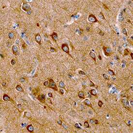 SALM2 was detected in immersion fixed paraffin-embedded sections of human cerebellum using Human SALM2/LRFN1 Monoclonal Antibody (Catalog # MAB5669) at 15 µg/mL overnight at 4 °C. Before incubation with the primary antibody, tissue was subjected to heat-induced epitope retrieval using Antigen Retrieval Reagent-Basic (Catalog # CTS013). Tissue was stained using the Anti-Mouse HRP-DAB Cell & Tissue Staining Kit (brown; Catalog # CTS002) and counterstained with hematoxylin (blue). View our protocol for Chromogenic IHC Staining of Paraffin-embedded Tissue Sections.