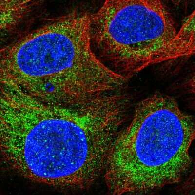 SARDH Antibody (NBP2-31705): Novus Biologicals