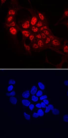 SART1 was detected in immersion fixed HepG2 human hepatocellular carcinoma cell line using Mouse Anti-Human SART1 Monoclonal Antibody (Catalog # MAB8034) at 10 µg/mL for 3 hours at room temperature. Cells were stained using the NorthernLights™ 557-conjugated Anti-Mouse IgG Secondary Antibody (red, upper panel; Catalog # NL007) and counterstained with DAPI (blue, lower panel). Specific staining was localized to nuclei. View our protocol for Fluorescent ICC Staining of Cells on Coverslips.