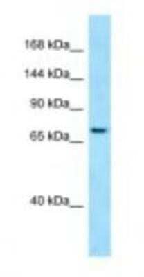 Western Blot: SBF1 Antibody [NBP1-98522] - 293T Cell Lysate 1.0ug/ml, Gel Concentration: 6-18%