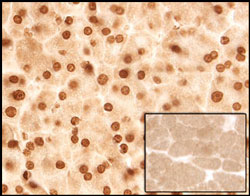 Sleeping Beauty Transposase (SBT) was detected in perfusion fixed paraffin-embedded sections of liver from SBT transgenic mice using 5 µg/mL Mouse Anti-Sleeping Beauty Transposase Monoclonal Antibody (Catalog # MAB2798) overnight at 4 °C. Before incubation with the primary antibody tissue was subjected to heat-induced epitope retrieval using Antigen Retrieval Reagent-Basic (Catalog # CTS013). Tissue was stained (brown). Inset panel shows a lack of labeling if primary antibodies are omitted and tissue is stained only with secondary antibody followed by incubation with detection reagents. View our protocol for Chromogenic IHC Staining of Paraffin-embedded Tissue Sections.