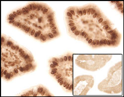 Sleeping Beauty Transposase (SBT) was detected in perfusion fixed paraffin-embedded sections of intestine from SBT transgenic mice using 5 µg/mL Mouse Anti-Sleeping Beauty Transposase Monoclonal Antibody (Catalog # MAB2798) overnight at 4 °C. Before incubation with the primary antibody tissue was subjected to heat-induced epitope retrieval using Antigen Retrieval Reagent-Basic (Catalog # CTS013). Tissue was stained (brown). Inset panel shows a lack of labeling if primary antibodies are omitted and tissue is stained only with secondary antibody followed by incubation with detection reagents. View our protocol for Chromogenic IHC Staining of Paraffin-embedded Tissue Sections.