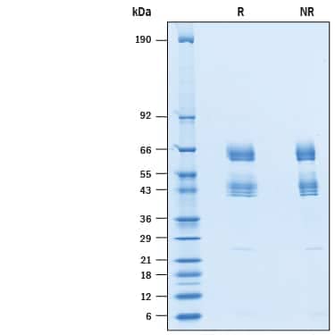 2 μg/lane of Recombinant Human SCG3 His-tag (Catalog # 10374-SC) was  resolved with SDS-PAGE under reducing (R) and non-reducing (NR)  conditions and visualized by Coomassie® Blue staining, showing bands at kDa.