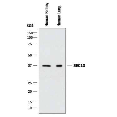 Western blot shows lysates of human kidney tissue and human lung tissue. PVDF membrane was probed with 0.05 µg/mL of Rabbit Anti-Human SEC13 Antigen Affinity-purified Polyclonal Antibody (Catalog # AF9055) followed by HRP-conjugated Anti-Rabbit IgG Secondary Antibody (Catalog # HAF008). A specific band was detected for SEC13 at approximately 37 kDa (as indicated). This experiment was conducted under reducing conditions and using Immunoblot Buffer Group 1.