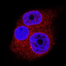 SUMO-Specific Peptidase 1/SENP1 was detected in immersion fixed T47D human breast cancer cell line using Sheep Anti-Human SUMO-Specific Peptidase 1/SENP1 Antigen Affinity-purified Polyclonal Antibody (Catalog # AF6587) at 5 µg/mL for 3 hours at room temperature. Cells were stained using the NorthernLights™ 557-conjugated Anti-Sheep IgG Secondary Antibody (red; Catalog # NL010) and counterstained with DAPI (blue). Specific staining was localized to cytoplasm and nuclei. View our protocol for Fluorescent ICC Staining of Cells on Coverslips.