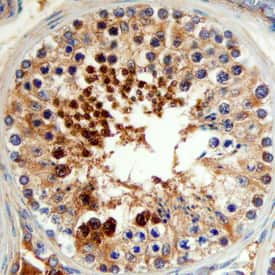 SUMO1-Specific Peptidase 1/SENP1 was detected in immersion fixed paraffin-embedded sections of human testis using Sheep Anti-Human SUMO1-Specific Peptidase 1/SENP1 Antigen Affinity-purified Polyclonal Antibody (Catalog # AF6587) at 3 µg/mL overnight at 4 °C. Before incubation with the primary antibody, tissue was subjected to heat-induced epitope retrieval using Antigen Retrieval Reagent-Basic (Catalog # CTS013). Tissue was stained using the Anti-Sheep HRP-DAB Cell & Tissue Staining Kit (brown; Catalog # CTS019) and counterstained with hematoxylin (blue). Specific staining was localized to late spermatids. View our protocol for Chromogenic IHC Staining of Paraffin-embedded Tissue Sections.