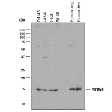 Western blot shows lysates of DU145 human prostate carcinoma cell line, Jurkat human acute T cell leukemia cell line, HeLa human cervical epithelial carcinoma cell line, WI-38 human lung fibroblast cell line, human lung tissue, and human liver tissue. PVDF membrane was probed with 2 µg/mL of Mouse Anti-Human SF20/MYDGF Monoclonal Antibody (Catalog # MAB1147) followed by HRP-conjugated Anti-Mouse IgG Secondary Antibody (Catalog # HAF018). A specific band was detected for SF20/MYDGF at approximately 18 kDa (as indicated). This experiment was conducted under reducing conditions and using Immunoblot Buffer Group 1.