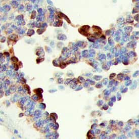 Immunohistochemistry SHB Antibody