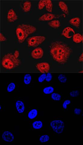 SHIP2 was detected in immersion fixed PC-3 human prostate cancer cell line using Sheep Anti-Human/Mouse/Rat SHIP2 Antigen Affinity-purified Polyclonal Antibody (Catalog # AF5389) at 10 µg/mL for 3 hours at room temperature. Cells were stained using the NorthernLights™ 557-conjugated Anti-Sheep IgG Secondary Antibody (red, upper panel; Catalog # NL010) and counterstained with DAPI (blue, lower panel). Specific staining was localized to nuclei and cytoplasm. View our protocol for Fluorescent ICC Staining of Cells on Coverslips. This application has not yet been tested in mouse or rat samples.