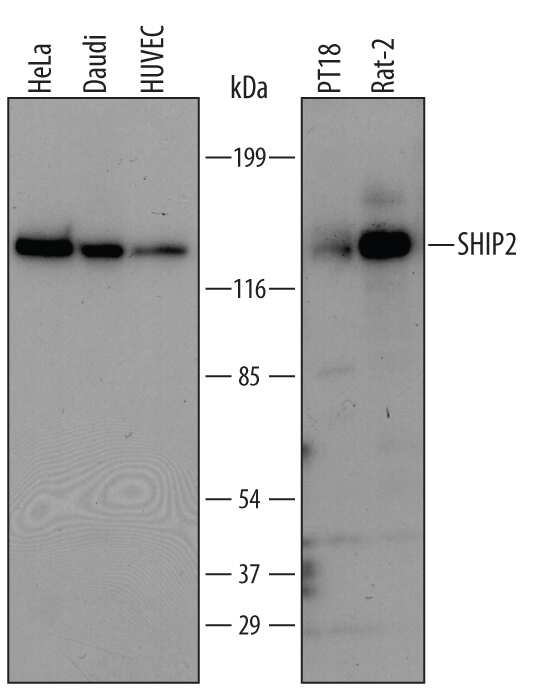 Western Blot SHIP2/INPPL1 Antibody [Unconjugated]