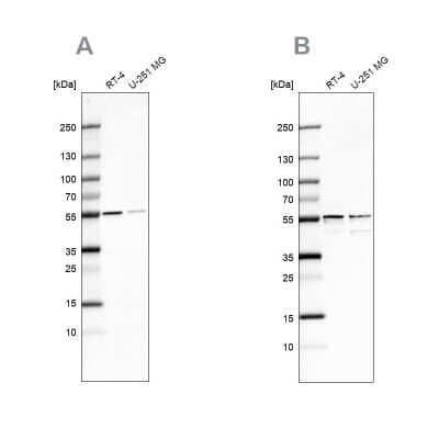 Western Blot: SHMT2 Antibody [NBP1-80754] - Analysis using Anti-SHMT2 antibody NBP1-80754 (A) shows similar pattern to independent antibody NBP1-80755 (B).