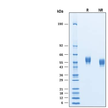 2 μg/lane of Recombinant Human SIRP beta 1/CD172b (Catalog #9978-SB) was resolved with SDS-PAGE under reducing (R) and non-reducing (NR)conditions and visualized by Coomassie® Blue staining, showing bands at 45-61 kDa, respectively.