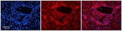 Immunocytochemistry/Immunofluorescence: SLC26A1 Antibody [NBP1-59652] - Formalin Fixed Paraffin; Embedded Tissue: Human Adult Liver; Observed Staining: Membrane in hepatocytes; Membrane and Cytoplasm in cells of the portal vein, hepatic arteries and bile ducts, strong signal, wide tissue distribution; Primary Antibody Concentration: 1:100