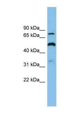 Western Blot: SLC26A1 Antibody [NBP1-59652] - Titration: 0.2-1 ug/ml, Positive Control: OVCAR-3 cell lysate.