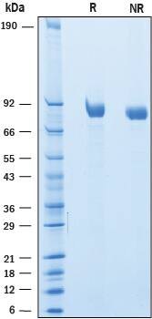 2 μg/lane of Recombinant Mouse SLITRK6 was resolved with SDS-PAGE underreducing (R) and non-reducing (NR) conditions and visualized by Coomassie® Bluestaining, showing bands at 80-90 kDa.