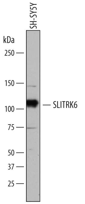 Western blot shows lysates of SH-SY5Y human neuroblastoma cell line. PVDF membrane was probed with 2 µg/mL of Sheep Anti-Human SLITRK6 Antigen Affinity-purified Polyclonal Antibody (Catalog # AF7317) followed by HRP-conjugated Anti-Sheep IgG Secondary Antibody (Catalog # HAF016). A specific band was detected for SLITRK6 at approximately 100 kDa (as indicated). This experiment was conducted under reducing conditions and using Immunoblot Buffer Group 1.