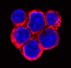 SLITRK6 was detected in immersion fixed Raji human Burkitt's lymphoma cell line using Mouse Anti-Human SLITRK6 Monoclonal Antibody (Catalog # MAB7317) at 10 µg/mL for 3 hours at room temperature. Cells were stained using the NorthernLights™ 557-conjugated Anti-Mouse IgG Secondary Antibody (red; Catalog # NL007) and counterstained with DAPI (blue). Specific staining was localized to plasma membrane. View our protocol for Fluorescent ICC Staining of Cells on Coverslips.
