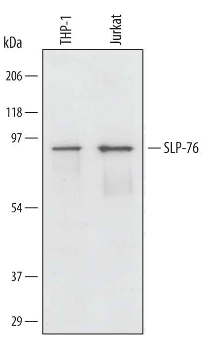 Western blot shows lysates of THP-1 human acute monocytic leukemia cell line and Jurkat human acute T cell leukemia cell line. PVDF membrane was probed with 1 µg/mL of Human SLP-76/LCP2 Monoclonal Antibody (Catalog # MAB5637) followed by HRP-conjugated Anti-Mouse IgG Secondary Antibody (Catalog # HAF007). A specific band was detected for SLP-76/LCP2 at approximately 90 kDa (as indicated). This experiment was conducted under reducing conditions and using Immunoblot Buffer Group 1.