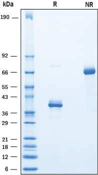 2 μg/lane of Recombinant Human SLURP2 Fc Chimera was resolved with SDS-PAGE underreducing (R) and non-reducing (NR) conditions and visualized by Coomassie® Bluestaining, showing bands at 36-43 kDa and 70-85 kDa, respectively.
