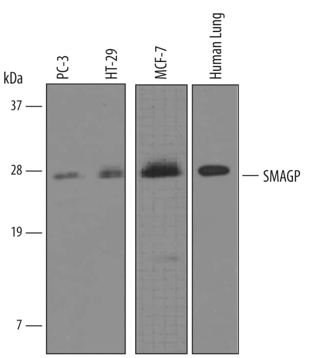Western blot shows lysates of human lung tissue, PC-3 human prostate cancer cell line, HT-29 human colon adenocarcinoma cell line, and MCF-7 human breast cancer cell line. PVDF membrane was probed with 1 µg/mL of Goat Anti-Human SMAGP Antigen Affinity-purified Polyclonal Antibody (Catalog # AF3959) followed by HRP-conjugated Anti-Goat IgG Secondary Antibody (Catalog # HAF019). A specific band was detected for SMAGP at approximately 26 kDa (as indicated). This experiment was conducted under reducing conditions and using Immunoblot Buffer Group 8.