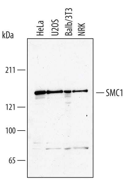 Western blot shows lysates of HeLa human cervical epithelial carcinoma cell line, U2OS human osteosarcoma cell line, Balb/3T3 mouse embryonic fibroblast cell line, and NRK rat normal kidney cell line. PVDF membrane was probed with 0.5 µg/mL of Human SMC1 Antigen Affinity-purified Polyclonal Antibody (Catalog # AF3294) followed by HRP-conjugated Anti-Goat IgG Secondary Antibody (Catalog # HAF017). A specific band was detected for SMC1 at approximately 145 kDa (as indicated). This experiment was conducted under reducing conditions and using Immunoblot Buffer Group 1.