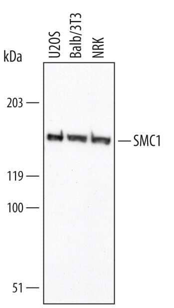 Western blot shows lysates of U2OS human osteosarcoma cell line, Balb/3T3 mouse embryonic fibroblast cell line, and NRK rat normal kidney cell line. PVDF membrane was probed with 0.25 µg/mL of Human/Mouse/Rat SMC1 Monoclonal Antibody (Catalog # MAB3294) followed by HRP-conjugated Anti-Mouse IgG Secondary Antibody (Catalog # HAF007). A specific band was detected for SMC1 at approximately 145 kDa (as indicated). This experiment was conducted under reducing conditions and using Immunoblot Buffer Group 1.