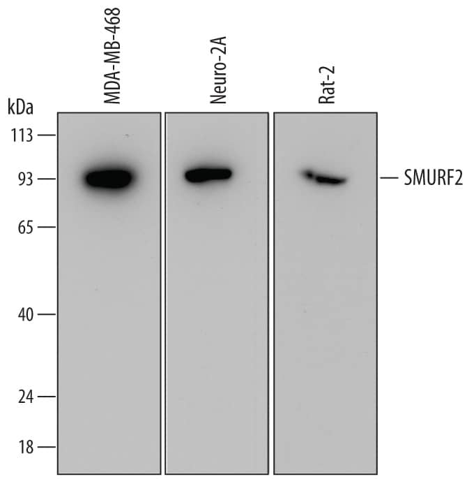 Western blot shows lysates of MDA-MB-468 human breast cancer cell line, Neuro-2A mouse neuroblastoma cell line, and Rat-2 rat embryonic fibroblast cell line. PVDF membrane was probed with 1 µg/mL of Mouse Anti-Human SMURF2 Monoclonal Antibody (Catalog # MAB6916) followed by HRP-conjugated Anti-Mouse IgG Secondary Antibody (Catalog # HAF007). A specific band was detected for SMURF2 at approximately 93 kDa (as indicated). This experiment was conducted under reducing conditions and using Immunoblot Buffer Group 2.