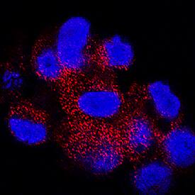 SNAP29 was detected in immersion fixed HepG2 human hepatocellular carcinoma cell line using Mouse Anti-Human SNAP29 Monoclonal Antibody (Catalog # MAB7869) at 25 µg/mL for 3 hours at room temperature. Cells were stained using the NorthernLights™ 557-conjugated Anti-Mouse IgG Secondary Antibody (red; Catalog # NL007) and counterstained with DAPI (blue). Specific staining was localized to cytoplasm. View our protocol for Fluorescent ICC Staining of Cells on Coverslips.